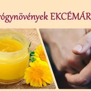 Gyógynövény ekcémára: 5+1 is segíthet, receptekkel!